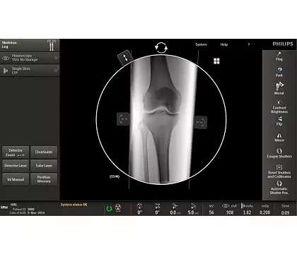 Описание и характеристики Philips Veradius Unity С-дуга