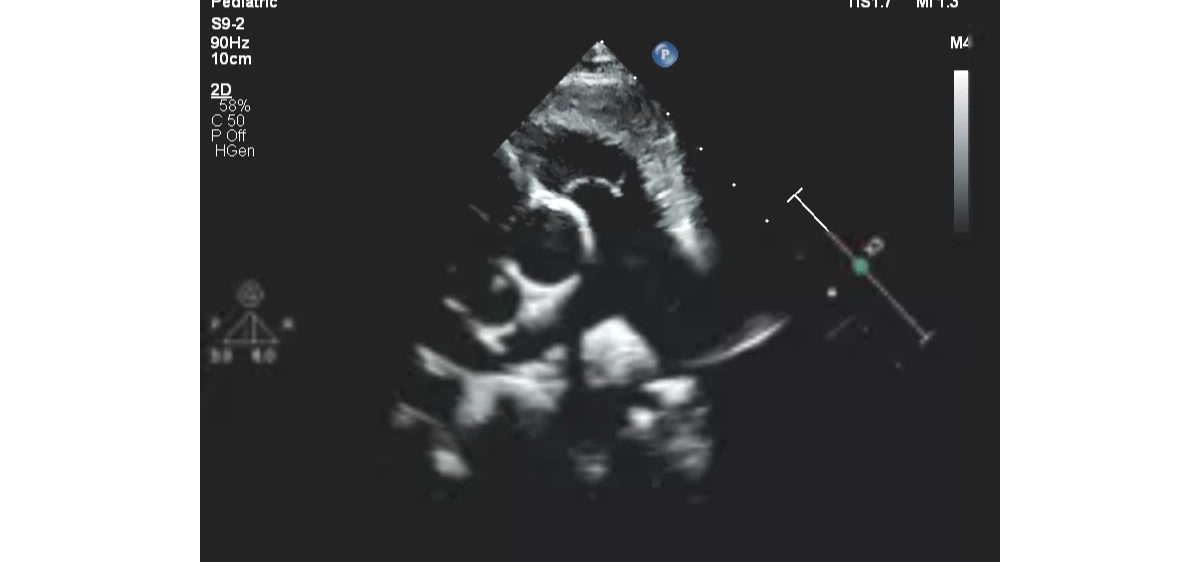Описание и характеристики Philips EPIQ CVx ультразвуковой аппарат