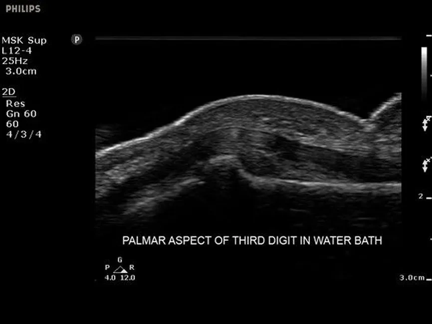 Описание и характеристики Philips Sparq ультразвуковой аппарат