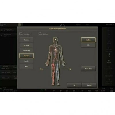 Philips Veradius Unity С-дуга Philips Veradius Unity С-дуга