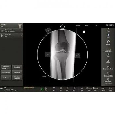 Philips Veradius Unity С-дуга Philips Veradius Unity С-дуга