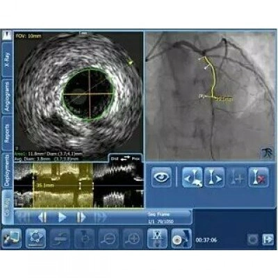 Philips SyncVision Cистема для выполнения высокоточной терапии Philips SyncVision Cистема для выполнения высокоточной терапии