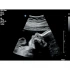 Philips Affiniti 70 ультразвуковой аппарат Philips Affiniti 70 ультразвуковой аппарат
