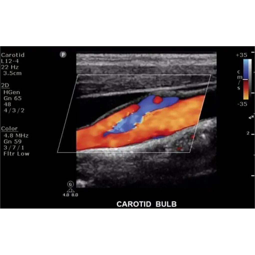 Philips ClearVue 550 ультразвуковой аппарат Philips ClearVue 550 ультразвуковой аппарат